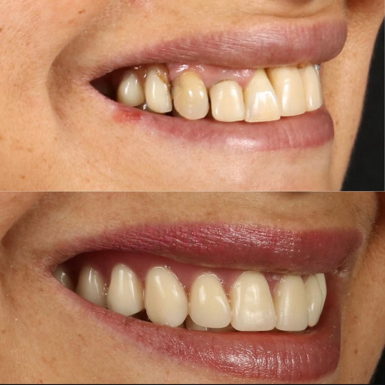 Tratamiento odontología general 3